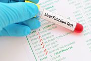 Book Home visit Blood Test for Liver